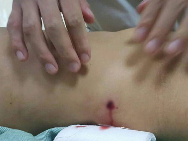 Vụ hai nhóm nổ súng hỗn chiến khiến cô gái thủng đại tràng tại Hà Nội: Công an triệu tập một số đối tượng