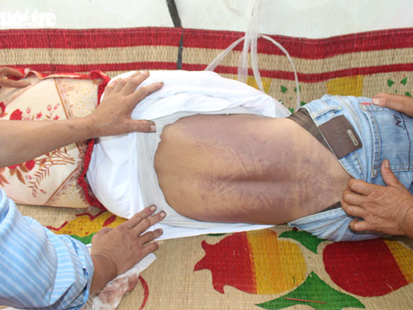 Nghi phạm tử vong tại công an huyện do nhồi máu cơ tim