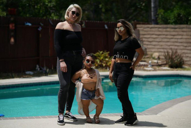 Người mẫu cao 1 mét phá vỡ mọi chuẩn mực của làng thời trang thế giới