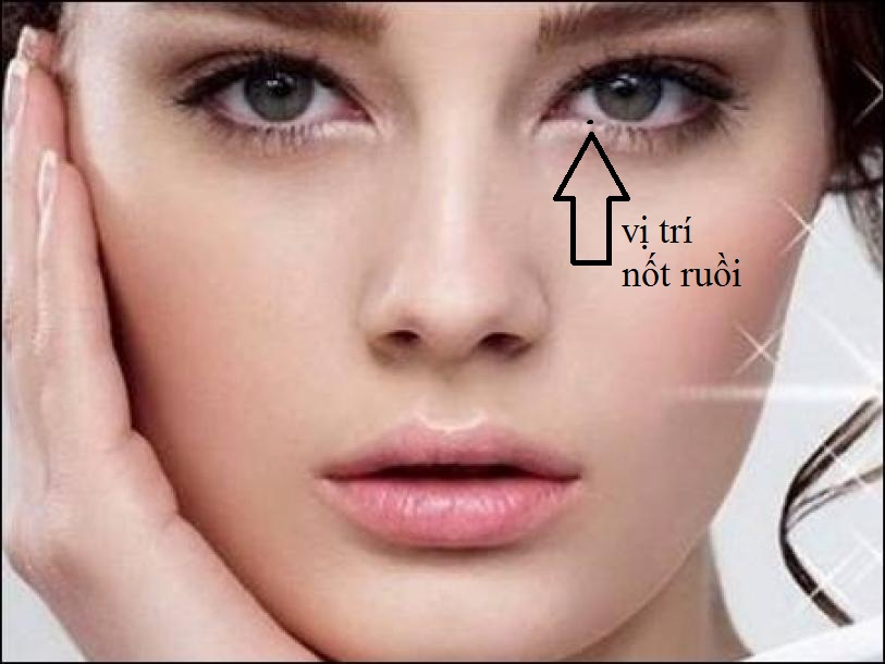 Khám phá ý nghĩa đặc biệt của nốt ruồi mọc trong mắt