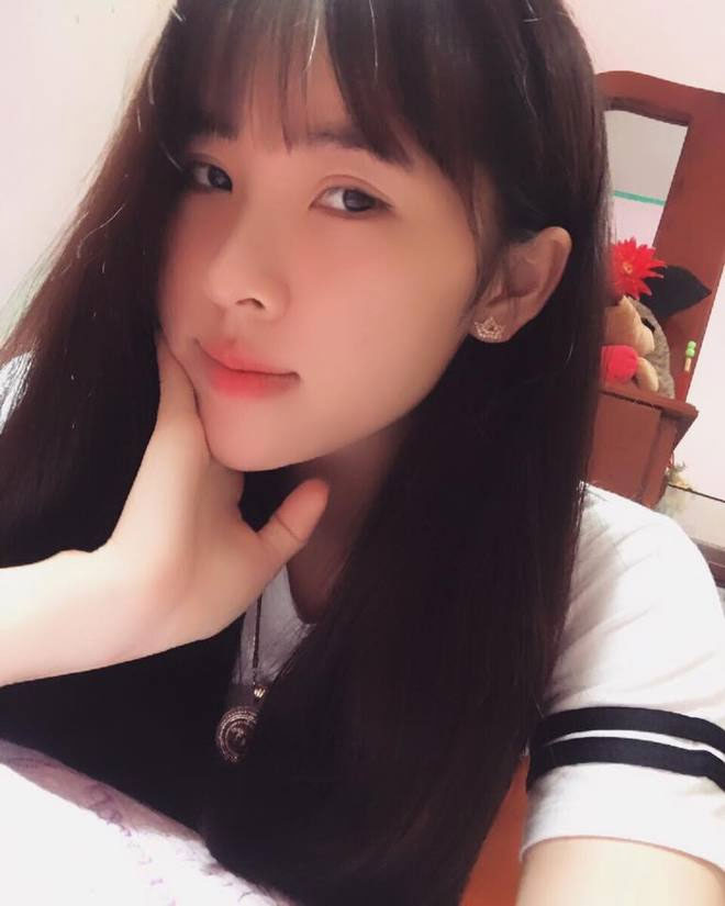 Bốn lần phẫu thuật thẩm mỹ giúp cô gái xấu xí hóa xinh đẹp