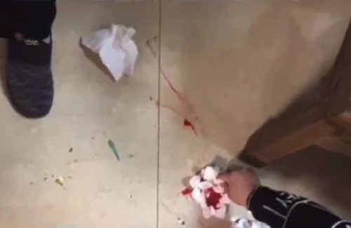 Đến rước dâu, chú rể cầm búa đập cửa khiến dàn phù dâu bị thương nặng Đến rước dâu, chú rể cầm búa đập cửa khiến dàn phù dâu bị thương nặng