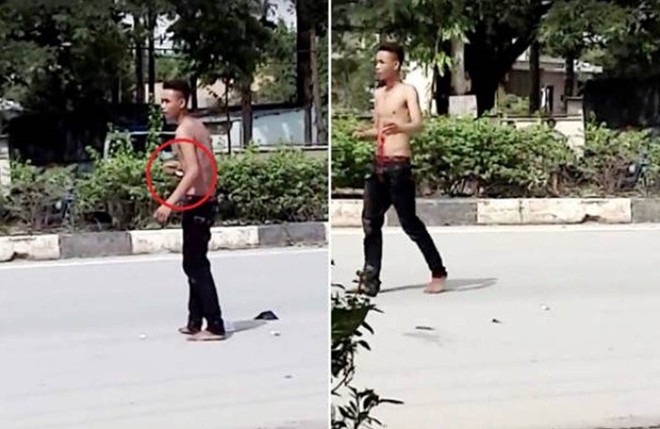 Nam thanh niên nghi ngáo đá tự đâm xổ ruột giữa đường