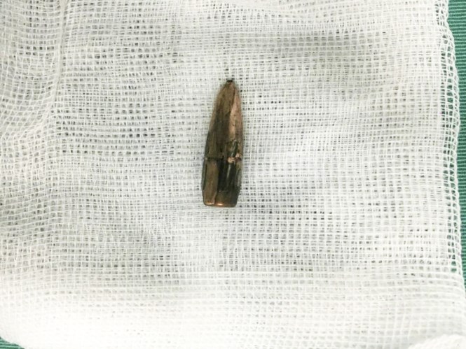 Thông tin mới vụ đạn “rơi” ở Vĩnh Phúc