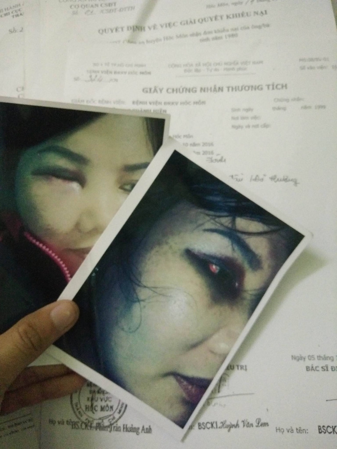 Bị người yêu của chồng kéo đến nhà đánh bầm mặt, chảy máu đầu, người phụ nữ hơn 1 năm đi kiện