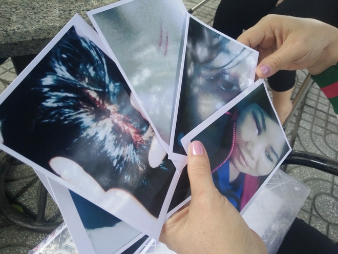 Bị người yêu của chồng kéo đến nhà đánh bầm mặt, chảy máu đầu, người phụ nữ hơn 1 năm đi kiện