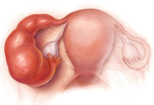 Lý giải những nguyên nhân gây đau bụng dưới ở phụ nữ Lý giải những nguyên nhân gây đau bụng dưới ở phụ nữ
