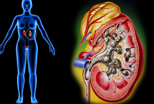Lý giải những nguyên nhân gây đau bụng dưới ở phụ nữ Lý giải những nguyên nhân gây đau bụng dưới ở phụ nữ