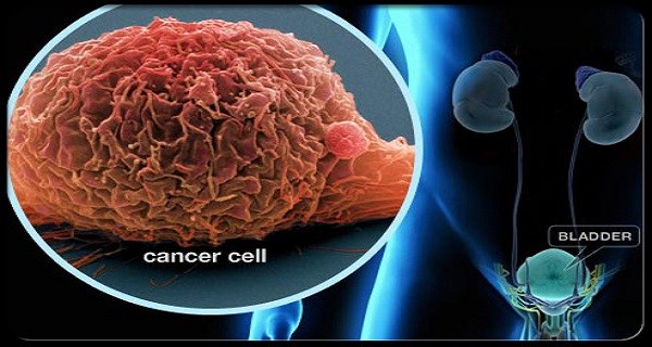 10 loại thực phẩm càng ăn càng nuôi ung thư