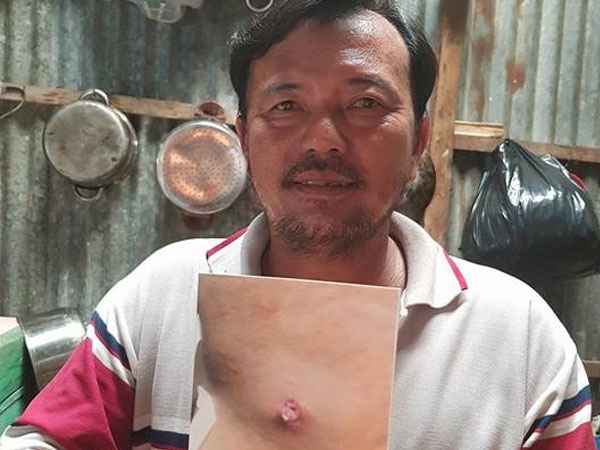 Khuất tất trong vụ cán bộ quản lý thị trường bắn dân ở An Giang