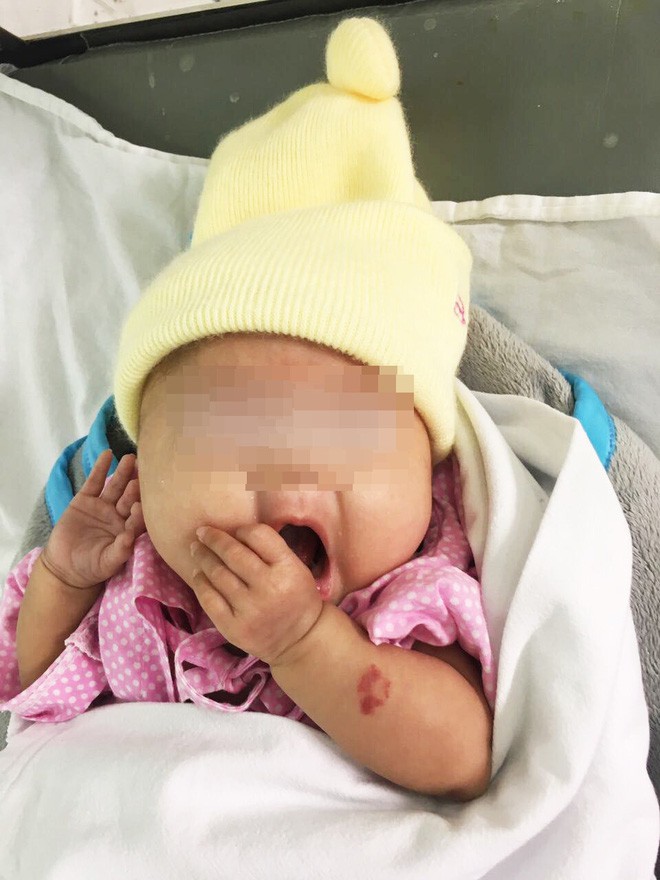 Đôi vợ chồng hiếm muộn vỡ òa khi con gái sinh ra chỉ 24 tuần tuổi, nặng 660 gram được cứu khỏi tử thần