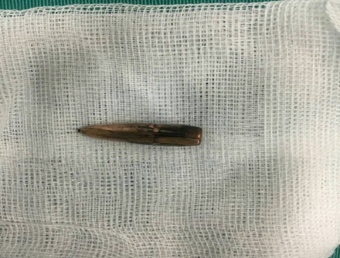 Dừng hoạt động các trường bắn để điều tra vụ đạn rơi ở Vĩnh Phúc