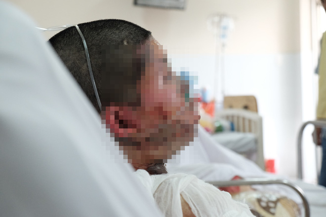 Tây Ninh: Chồng cũ tạt xăng châm lửa đốt vợ và người yêu mới nguy kịch