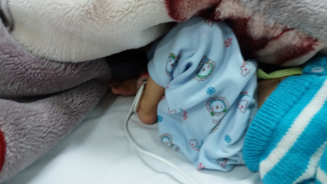 Mẹ của bé trai sinh ra có đầu to như quả bóng: Chồng và gia đình chồng đều bỏ mẹ con tôi