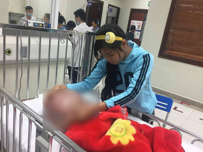 Bé trai 13 tháng tuổi chịu đau đớn từng ngày vì đầu to, mặt không giống ai