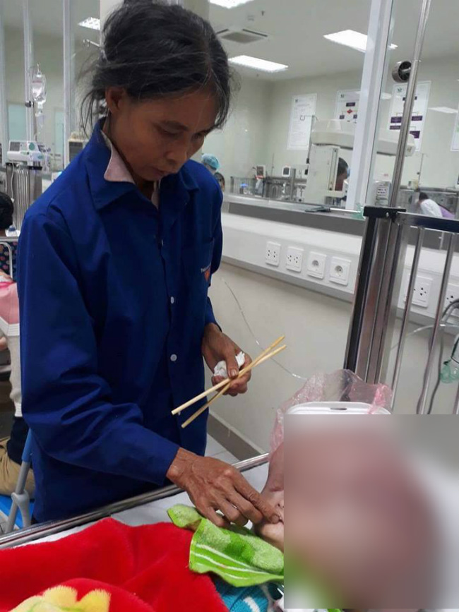 Bé trai 13 tháng tuổi chịu đau đớn từng ngày vì đầu to, mặt không giống ai