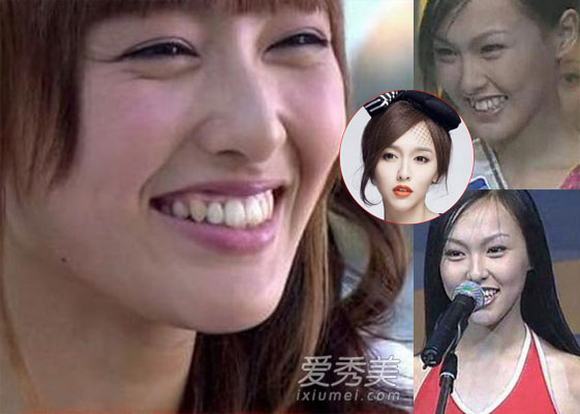 Những khoảnh khắc xấu tệ của mỹ nhân Hoa ngữ