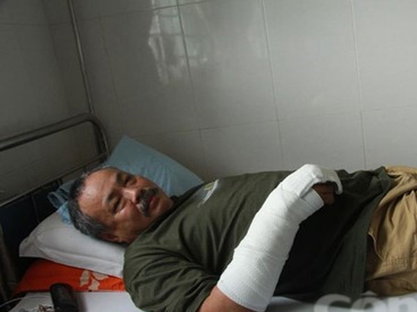 Tên trộm đâm chủ nhà nhiều nhát rồi bỏ chạy khi bị phát hiện