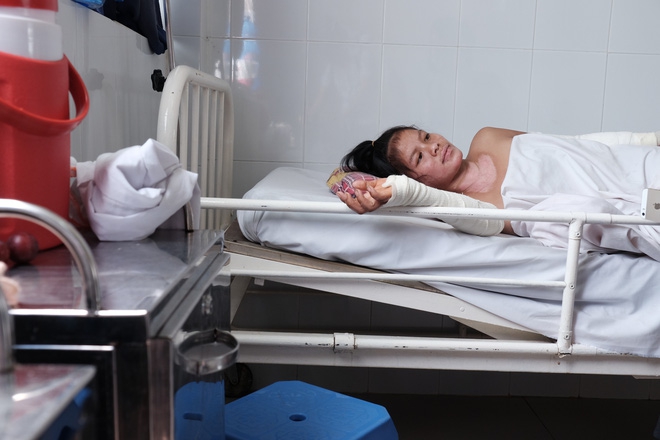 Nến rớt xuống bình xăng dưới giường, hai mẹ con thai phụ bỏng nặng, chồng chưa cưới ôm tiền ủng hộ bỏ trốn