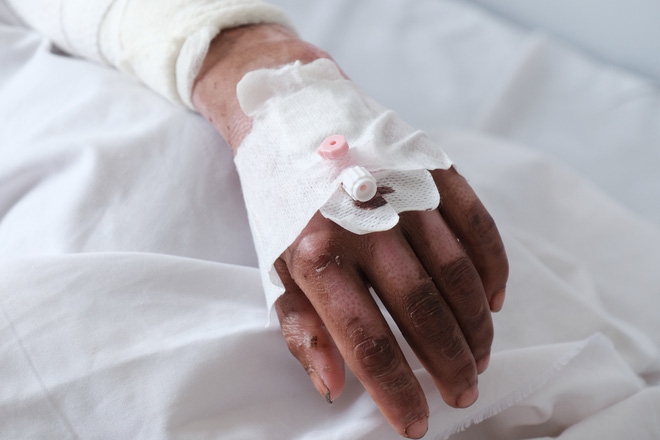 Nến rớt xuống bình xăng dưới giường, hai mẹ con thai phụ bỏng nặng, chồng chưa cưới ôm tiền ủng hộ bỏ trốn