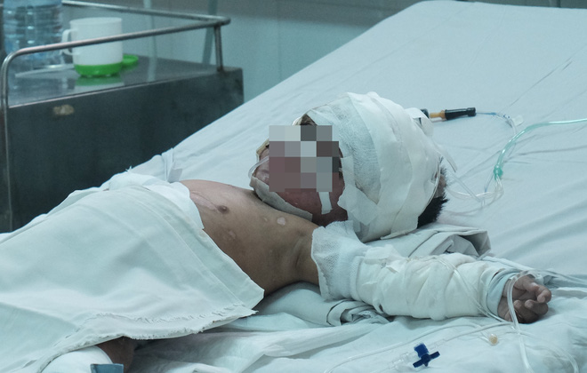 Nến rớt xuống bình xăng dưới giường, hai mẹ con thai phụ bỏng nặng, chồng chưa cưới ôm tiền ủng hộ bỏ trốn