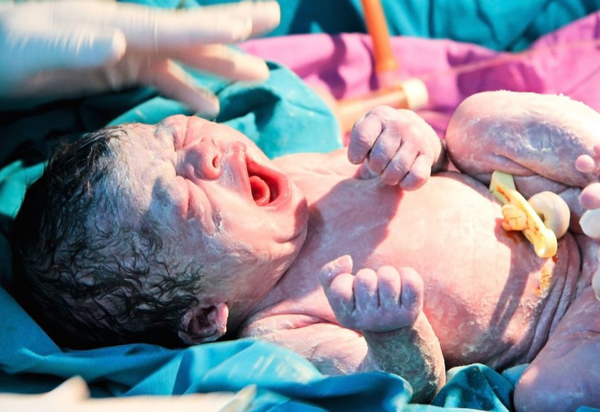 Quá ngày dự sinh 2 tuần vẫn lì không đến bệnh viện, mẹ suýt hại chết con