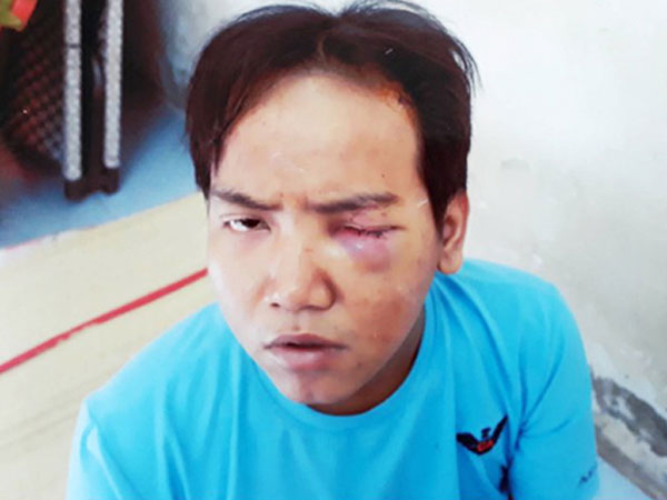 Phường ở TP HCM không biết bảo vệ dân phố sát hại bé trai bị tâm thần