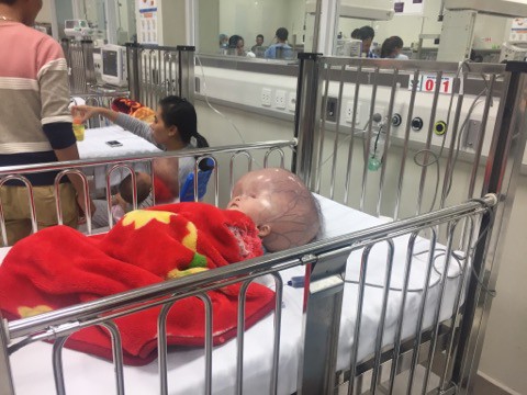 Sau thời gian chống chọi với bệnh tật, bé trai bị não úng thủy ở Thanh Hóa đã qua đời