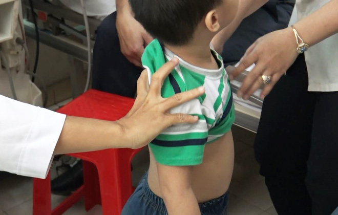 Vụ bảo mẫu bạo hành trẻ em tại Mầm Xanh: Nhiều trẻ quấy khóc, mất ngủ về đêm, thậm chí có triệu chứng tự kỷ