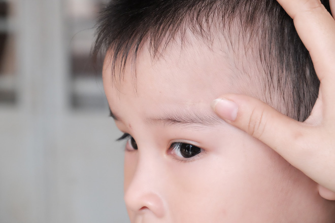 Vụ bảo mẫu bạo hành trẻ em tại Mầm Xanh: Nhiều trẻ quấy khóc, mất ngủ về đêm, thậm chí có triệu chứng tự kỷ