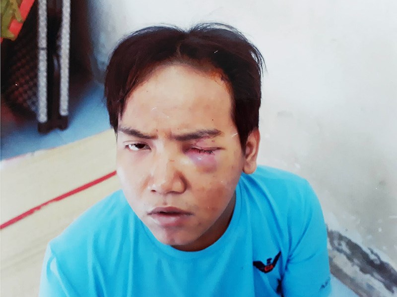 Hé lộ nguyên nhân bảo vệ dân phố sát hại bé trai 6 tuổi