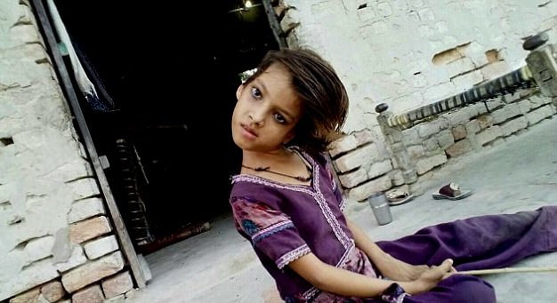 Cô bé chỉ nhìn thôi đã mỏi: Đầu cổ luôn cong vẹo 90 độ đến mức không đi được