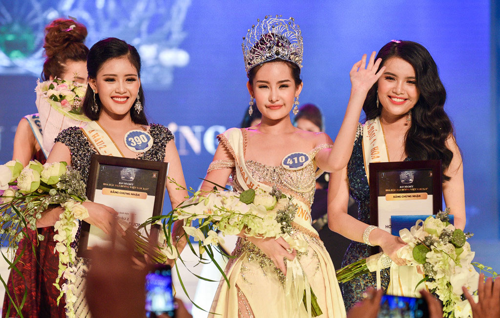 Tân Hoa hậu Đại dương: Tôi đã sửa mũi nhưng môi là tự nhiên