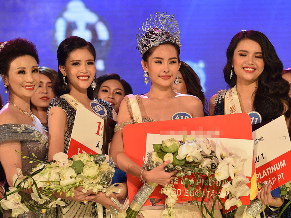 Tân Hoa hậu Đại dương: Tôi đã sửa mũi nhưng môi là tự nhiên