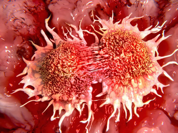 Phó giám đốc Bệnh viện Ung bướu chỉ rõ nguyên nhân ngày càng nhiều người trẻ mắc ung thư