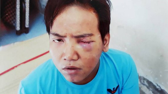 Khi nào bệnh nhân tâm thần phân liệt trở thành sát nhân tàn bạo?