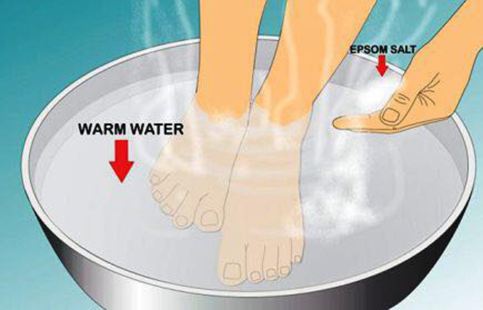 Xử trí khi móng chân mọc đâm chọc vào da