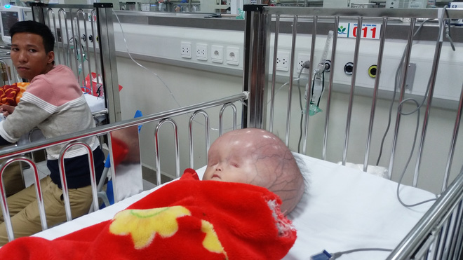 Người mẹ bị tố không đồng ý đưa con bị não úng thủy sang Singapore chữa trị lên tiếng