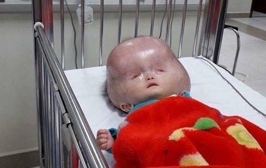 Người mẹ bị tố không đồng ý đưa con bị não úng thủy sang Singapore chữa trị lên tiếng