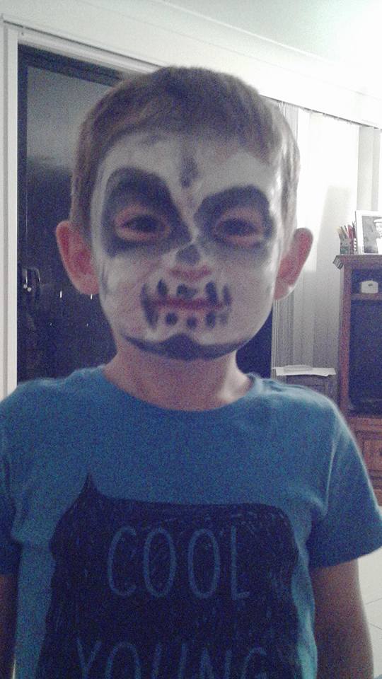 Cậu bé 4 tuổi bị bỏng mặt vì sơn vẽ hóa trang Halloween