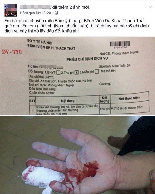 Bi hài nam bệnh nhân bị rách tay được chỉ định khâu... cô bé