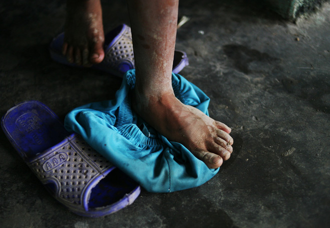 Hà Nội: Tận cùng nỗi đau, sự khốn khổ của một gia đình có nhiều người tâm thần