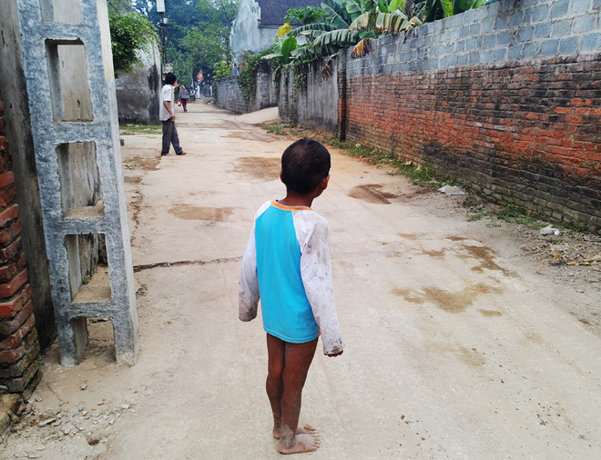 Hà Nội: Tận cùng nỗi đau, sự khốn khổ của một gia đình có nhiều người tâm thần