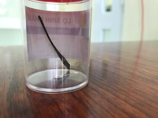 Tăm tre đâm thủng ruột cụ bà