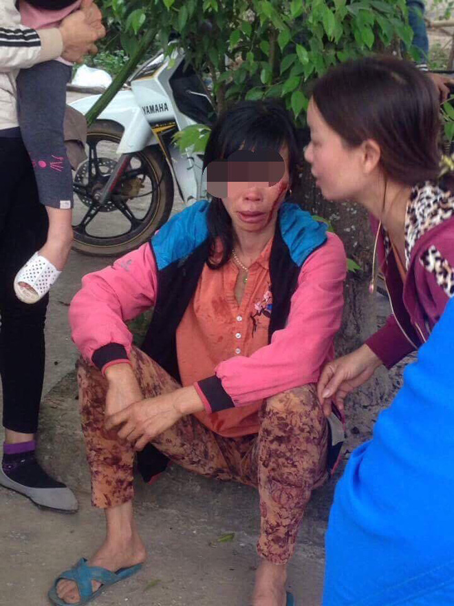 Vợ bị bồ đánh bật máu ngay ở chợ, chồng thờ ơ không can ngăn?