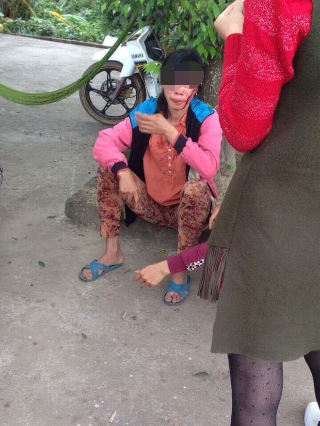 Vợ bị bồ đánh bật máu ngay ở chợ, chồng thờ ơ không can ngăn?