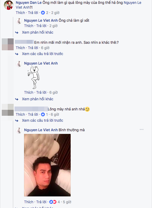 Sau răng sứ, diễn viên Việt Anh lại bị bạn bè soi thêm điểm lạ trên gương mặt