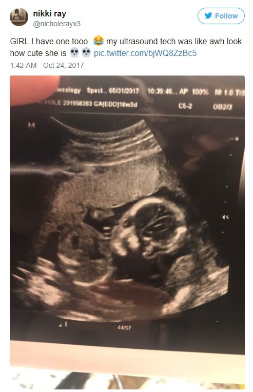 Mẹ trẻ Úc vừa chia sẻ ảnh siêu âm, cư dân mạng liền hốt hoảng gọi đứa trẻ trong bụng cô là “ác quỷ”