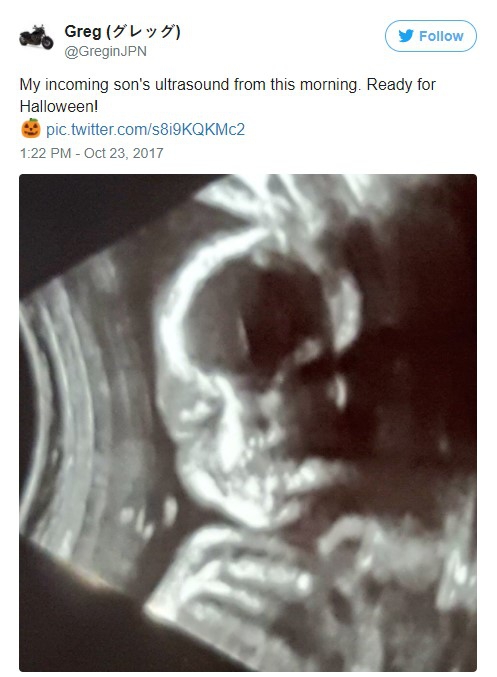 Mẹ trẻ Úc vừa chia sẻ ảnh siêu âm, cư dân mạng liền hốt hoảng gọi đứa trẻ trong bụng cô là “ác quỷ”