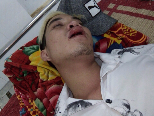 Xác minh thông tin CSGT đánh người vi phạm giao thông